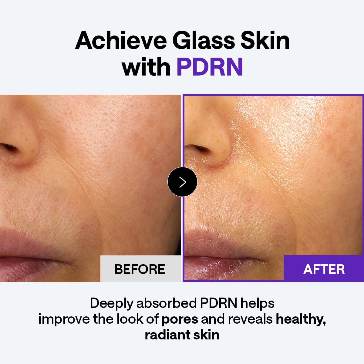 Amazon.com: Mediheal Derma Cream [PDRN] – Pore Minimizing